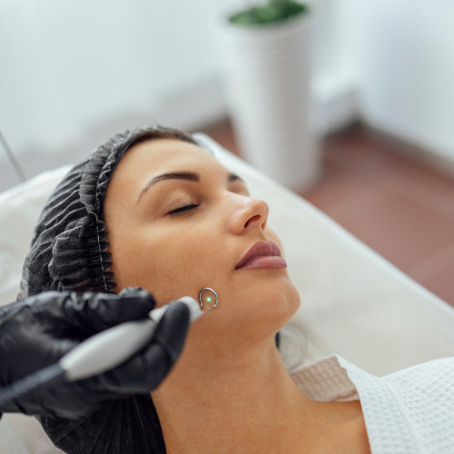 Acne scar treatment